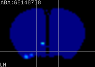 ABA expression energy