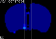 ABA expression energy