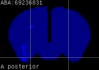 ABA expression energy