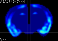 ABA expression energy