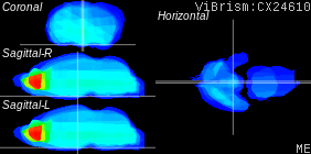 ViBrism